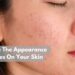How To Minimize The Appearance Of Pores On Your Skin?